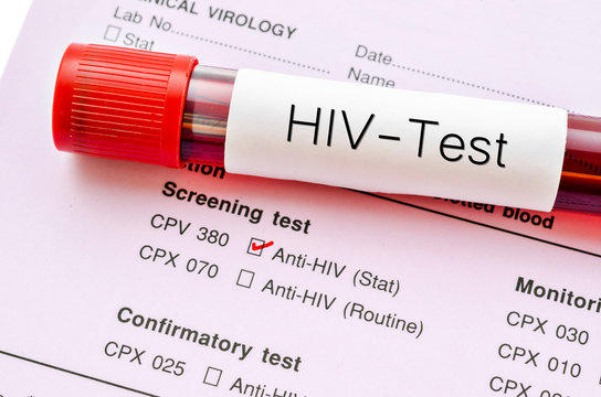 HIV test, HIV infection screening test form.