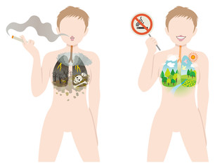 喫煙と禁煙
