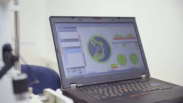 Computer screen with Ophthalmic data close up 4K