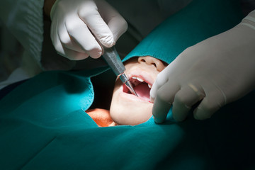 Dental, dentist using dental Hakka. Extracting a tooth