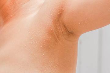 Sweat on body of woman ,.Health Concept
