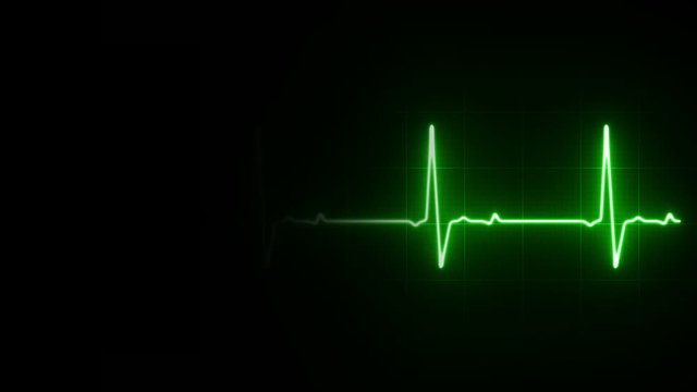 EKG Heart Line Footage Loop