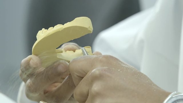 Dentist hands work on a teeth mould. 
(Filmed in ProRes with high dynamic range for flexibility for image grading)