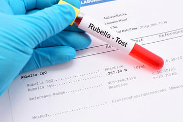 Blood sample for rubella virus test with result