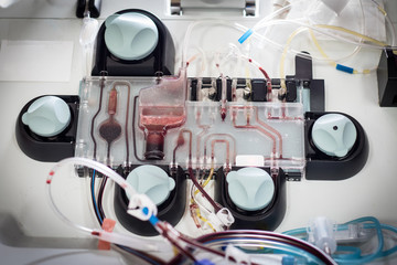 Single Donor Platelets Blood separation machine