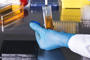scientist collecting a sample from a test tube for a clinical test / hands of technician working in...
