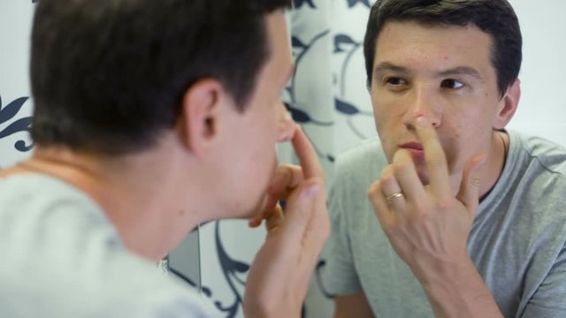 Man with Problem Skin in front of the mirror