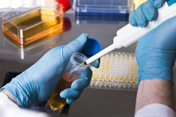 scientist pipetting a sample from a test tube for a clinical test / Hands of technician working in the laboratory with samples in microplates in the sterile hood