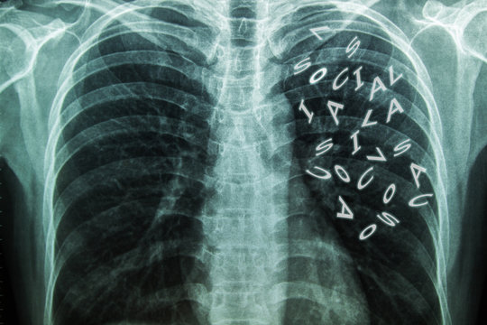 X-Ray Image Of Human Chest with English letter "Social".