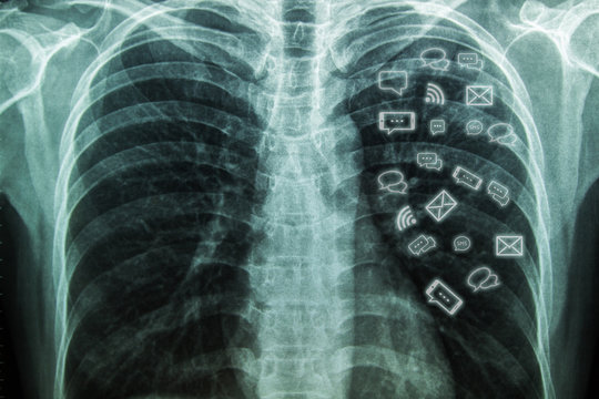 X-Ray Image Of Human Chest with Message icon.