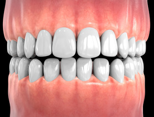 3D Isolated Teeth. Tooths Dentistry Care Concept