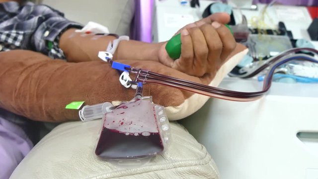 blood donor squeezes the ball in his hand during single donor platelets blood separation machine working