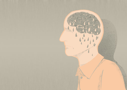 Illustrazione di malato di alzheimer e perdita di memoria 