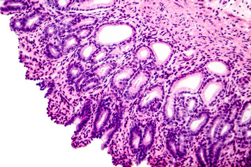 Cross section of stomach. Light micrograph showing stomach epithelium