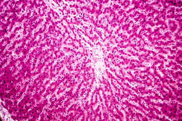 Light micrograph of a liver showing cords made from hepatocytes and clear spaces between them called hepatic sinusoids and filled with red blood cells. Magnification 200x