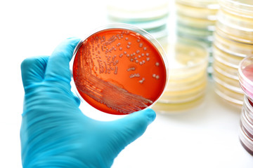 Colonies of bacteria in petri dish (blood agar)
