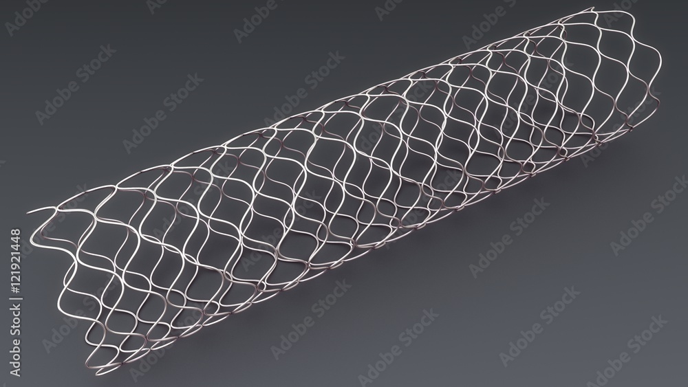 Canvas Prints angioplasty stent