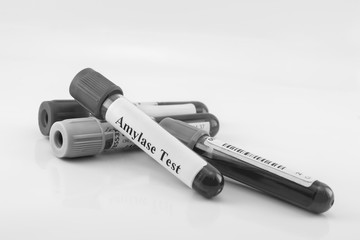 Test tubes collecting for medical laboratory on white background