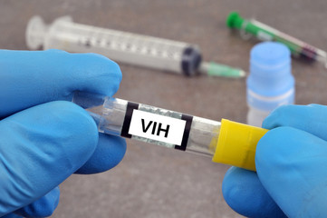 Test de VIH