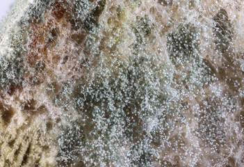 Mold on slices of bread - health problem - microscopic photo