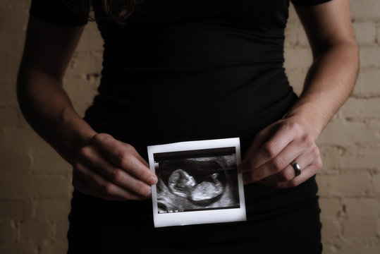 Pregnant women holds sonogram of baby