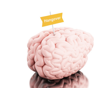 3d Brain with a signboard and word hangover.