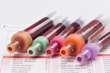 Blutuntersuchung, Blutproben auf einem Laborformular
