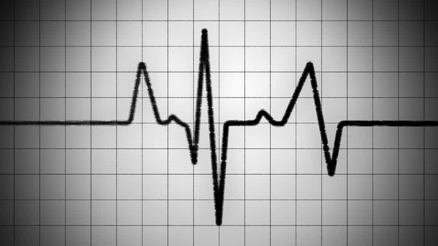 A 15 second loop of a Heart Monitor (EGK) with grunge line and spotlight. HD 1080i.