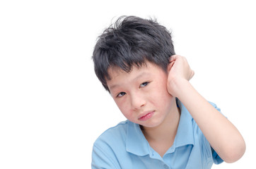 Young asian boy scratching his allergy skin