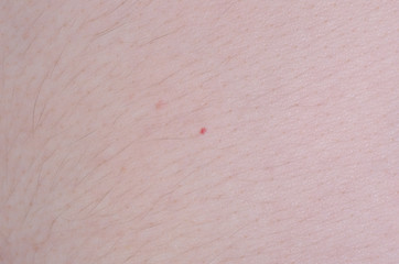 Fototapeta premium Small magenta dot's on the skin.