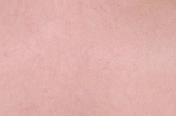 Blood vessels on woman leg, closeup.