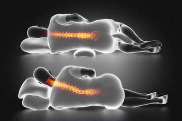 Man sleep posture comparison
