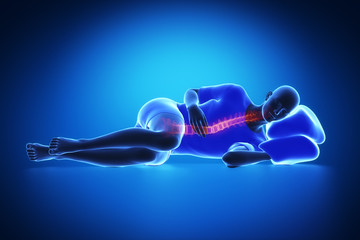 Man bad inccorect sleep posturex-tay blue