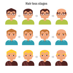 Types of hair loss.