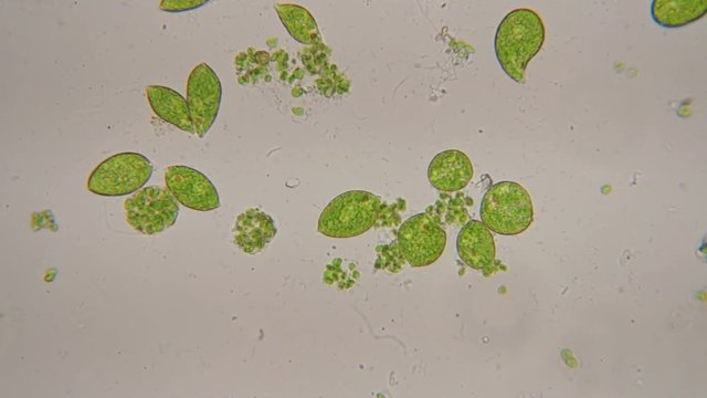 Motion of single-celled protozoa (Euglena) under microscope