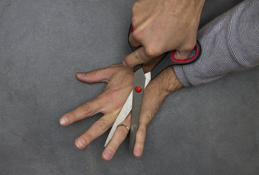 man cuts scissors finger with wedding ring