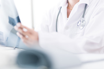 Woman Doctor Looking at X-Ray Radiography in patient's Room