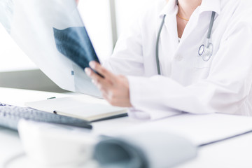 Woman Doctor Looking at X-Ray Radiography in patient's Room