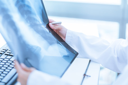 Woman Doctor Looking at X-Ray Radiography in patient's Room