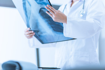 Woman Doctor Looking at X-Ray Radiography in patient's Room