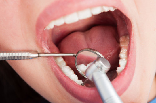 Close-up of lady having dentist consult