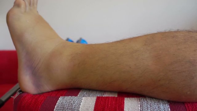 injured broken ankle dolly motion