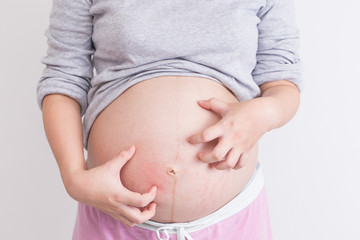 Pregnant woman scratching her belly