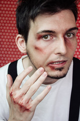 Hombre joven lleno de heridas tras una pelea - obrazy, fototapety, plakaty