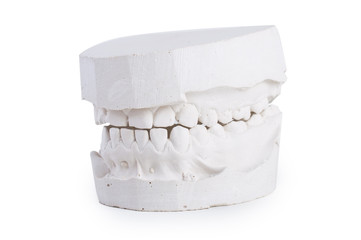 made from plaster mold of the teeth on a white background