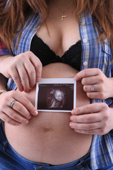 pregnancy woman with ultrasound photo