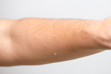 moisture sweat skin, arm with drop of water wet after sport. - obrazy, fototapety, plakaty
