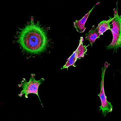 Immunofluorescence of multiple tumor cells grown in tissue culture - 122984448