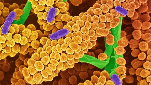 Streptococcus bacteria, SEM