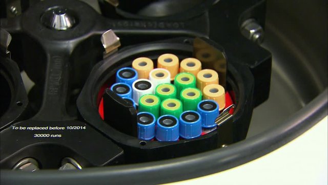 Centrifuge In Pathology Department